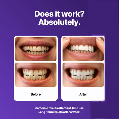 dr dent purple teeth whitening