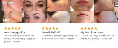 Professional High Frequency Facial Machine Electrotherapy