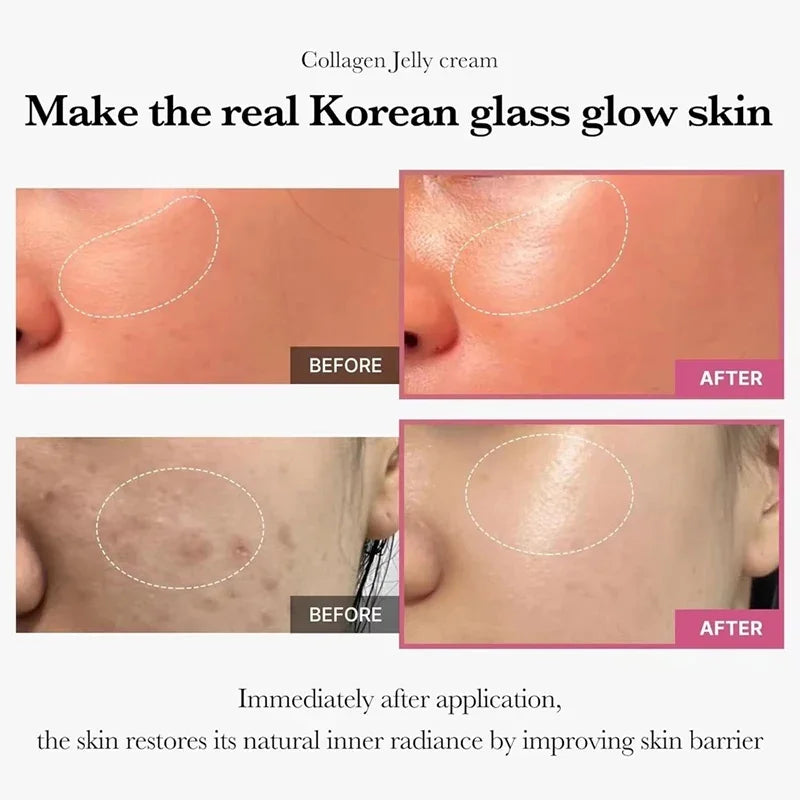 100g Jelly Face Cream Collagen Face Skin Care